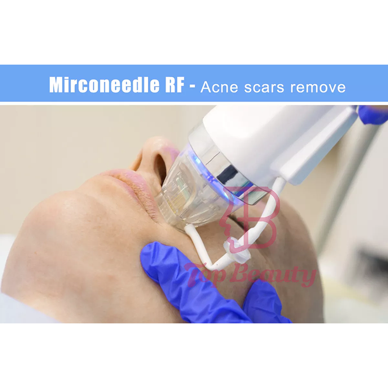 Appareil de microneedling fractionné RF à microneedles