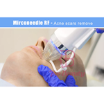 Appareil de microneedling fractionné RF à microneedles