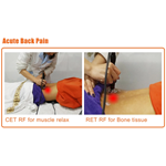 Thérapie Tecar Physio Machine RF Monopolaire Résistive et Capacitive Tecarterapia Professionnelle