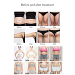 Appareil de massage professionnel de drainage lymphatique pour la réduction de la cellulite et l''amincissement avec rouleau à bille interne pour perte de poids