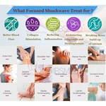Vente chaude système de choc eswt ed focus shockwave, machine de thérapie par choc ciblé, Shockwave Physique