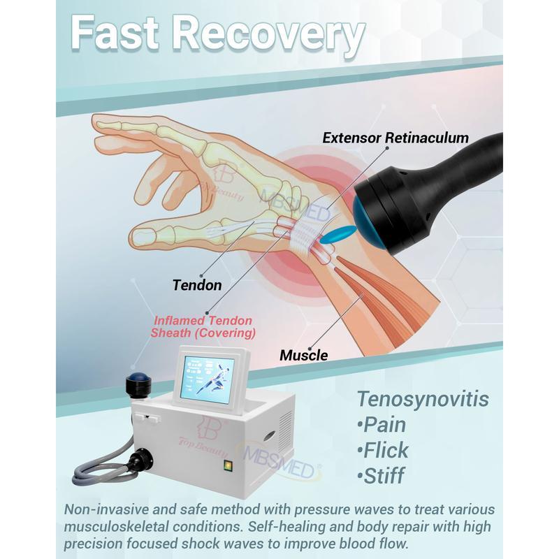 Vente chaude système de choc eswt ed focus shockwave, machine de thérapie par choc ciblé, Shockwave Physique