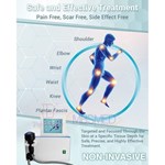 Vente chaude système de choc eswt ed focus shockwave, machine de thérapie par choc ciblé, Shockwave Physique