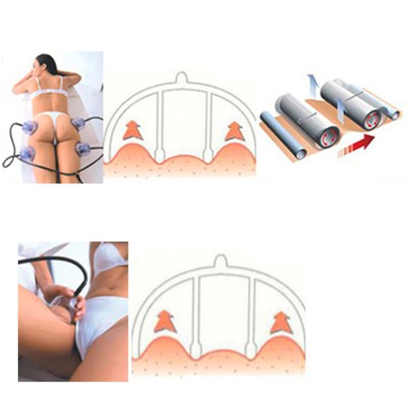 Thérapie par aspiration Starvac Sp2 Massage Thérapie par ventouses Massager amincissement du corps Machine à ventouse