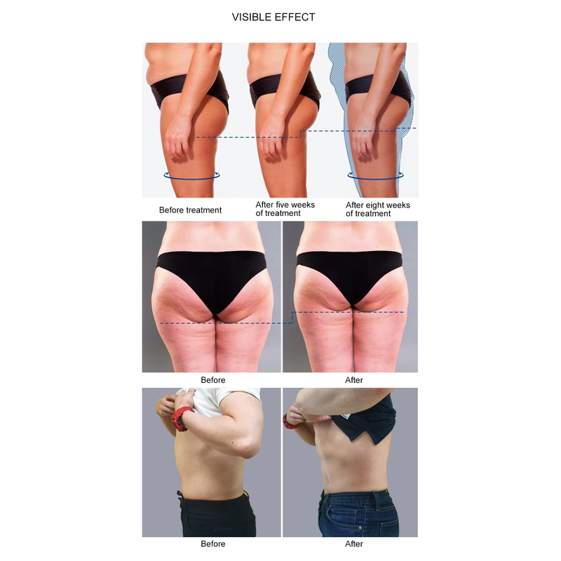 Machine de stimulation musculaire et de slimming du corps EMS portable et puissant