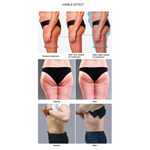 Machine de stimulation musculaire et de slimming du corps EMS portable et puissant